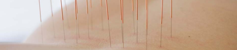 Acupunctuur_Timmermans_Waalwijk_acupunctuur_header