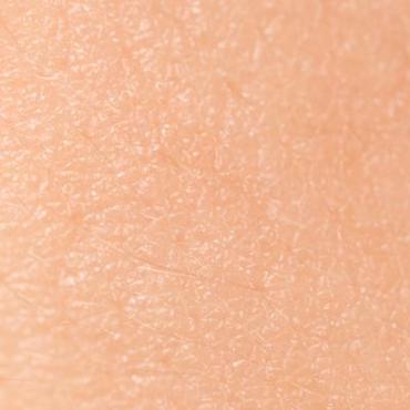 Acupunctuur_Timmermans_Waalwijk_klachten_huidproblemen